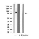 Western blot analysis of Gab2 expression in Jurkat cells