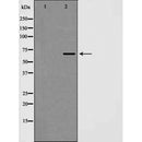 AF5408 at 1/100 staining Human prostate tissue by IHC-P. The sample was formaldehyde fixed and a heat mediated antigen retrieval step in citrate buffer was performed. The sample was then blocked and incubated with the antibody for 1.5 hours at 22¡ãC. An HRP conjugated goat anti-rabbit antibody was used as the secondary