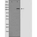 Western blot analysis of TERT expression in Jurkat cell extracts.The lane on the left is treated with the antigen-specific peptide.