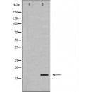 AF5414 at 1/100 staining Mouse testis tissue by IHC-P. The sample was formaldehyde fixed and a heat mediated antigen retrieval step in citrate buffer was performed. The sample was then blocked and incubated with the antibody for 1.5 hours at 22¡ãC. An HRP conjugated goat anti-rabbit antibody was used as the secondary