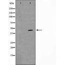 Western blot analysis of ATF-4 expression in A549 cells.The lane on the left is treated with the antigen-specific peptide.