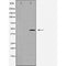 Western blot analysis of AF5418 expression in various lysates 1 Rat brain 2 mouse brain 3 mouse lung 4 HeLa 5 HEPG2 6 293  7 Mouse spleen 8 Rat heart