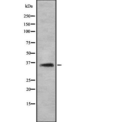 AF5420 at 1/100 staining Human uterus tissue by IHC-P. The sample was formaldehyde fixed and a heat mediated antigen retrieval step in citrate buffer was performed. The sample was then blocked and incubated with the antibody for 1.5 hours at 22¡ãC. An HRP conjugated goat anti-rabbit antibody was used as the secondary