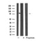 AF5421 at 1/100 staining Mouse lung tissue by IHC-P. The sample was formaldehyde fixed and a heat mediated antigen retrieval step in citrate buffer was performed. The sample was then blocked and incubated with the antibody for 1.5 hours at 22¡ãC. An HRP conjugated goat anti-rabbit antibody was used as the secondary