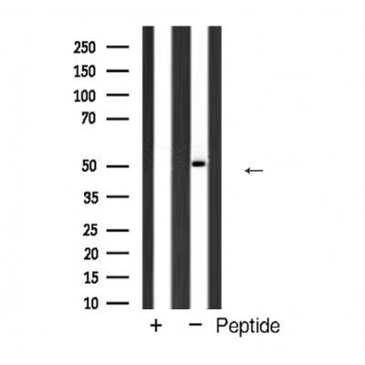 AF5422 staining NIH-3T3 by IF/ICC. The sample were fixed with PFA and permeabilized in 0.1% Triton X-100,then blocked in 10% serum for 45 minutes at 25¡ãC. The primary antibody was diluted at 1/200 and incubated with the sample for 1 hour at 37¡ãC. An  Alexa Fluor 594 conjugated goat anti-rabbit IgG (H+L) Ab, diluted at 1/600, was used as the secondary antibod