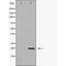 Western blot analysis of MRLC1 expression in K562 cell extract.The lane on the left is treated with the antigen-specific peptide.