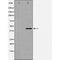 AF5424 at 1/100 staining Human lung tissue by IHC-P. The sample was formaldehyde fixed and a heat mediated antigen retrieval step in citrate buffer was performed. The sample was then blocked and incubated with the antibody for 1.5 hours at 22¡ãC. An HRP conjugated goat anti-rabbit antibody was used as the secondary