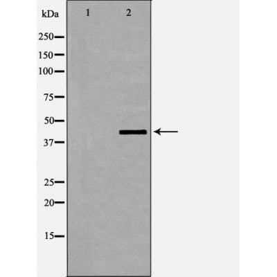 AF5424 at 1/100 staining Human lung tissue by IHC-P. The sample was formaldehyde fixed and a heat mediated antigen retrieval step in citrate buffer was performed. The sample was then blocked and incubated with the antibody for 1.5 hours at 22¡ãC. An HRP conjugated goat anti-rabbit antibody was used as the secondary