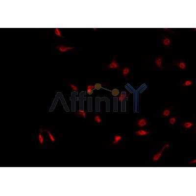AF5426 at 1/100 staining Mouse brain tissue by IHC-P. The sample was formaldehyde fixed and a heat mediated antigen retrieval step in citrate buffer was performed. The sample was then blocked and incubated with the antibody for 1.5 hours at 22¡ãC. An HRP conjugated goat anti-rabbit antibody was used as the secondary