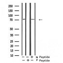Western blot analysis of Gab2 (Phospho-Ser623) expression in Jurkat cells