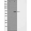 AF5428 at 1/100 staining Human prostate tissue by IHC-P. The sample was formaldehyde fixed and a heat mediated antigen retrieval step in citrate buffer was performed. The sample was then blocked and incubated with the antibody for 1.5 hours at 22¡ãC. An HRP conjugated goat anti-rabbit antibody was used as the secondary