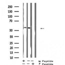 AF5432 staining Hela by IF/ICC. The sample were fixed with PFA and permeabilized in 0.1% Triton X-100,then blocked in 10% serum for 45 minutes at 25¡ãC. The primary antibody was diluted at 1/200 and incubated with the sample for 1 hour at 37¡ãC. An  Alexa Fluor 594 conjugated goat anti-rabbit IgG (H+L) Ab, diluted at 1/600, was used as the secondary antibod