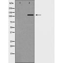 Western blot analysis of Telomerase (Phospho-Ser824) expression in Jurkat cell extracts.The lane on the left is treated with the antigen-specific peptide.