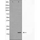 AF5434 at 1/100 staining Mouse testis tissue by IHC-P. The sample was formaldehyde fixed and a heat mediated antigen retrieval step in citrate buffer was performed. The sample was then blocked and incubated with the antibody for 1.5 hours at 22¡ãC. An HRP conjugated goat anti-rabbit antibody was used as the secondary