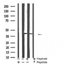 Western blot analysis of ATF-4 (Phospho-Ser219) expression in A549 cells