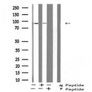 AF5437 at 1/100 staining Mouse lung tissue by IHC-P. The sample was formaldehyde fixed and a heat mediated antigen retrieval step in citrate buffer was performed. The sample was then blocked and incubated with the antibody for 1.5 hours at 22¡ãC. An HRP conjugated goat anti-rabbit antibody was used as the secondary