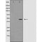 Western blot analysis of extracts from Rat heart, using Caspase 1 (Phospho-Ser376) Antibody. Lane 1 was treated with the blocking peptide.