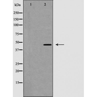 Western blot analysis of extracts from Rat heart, using Caspase 1 (Phospho-Ser376) Antibody. Lane 1 was treated with the blocking peptide.