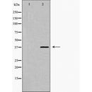 AF5439 at 1/100 staining Mouse brain tissue by IHC-P. The sample was formaldehyde fixed and a heat mediated antigen retrieval step in citrate buffer was performed. The sample was then blocked and incubated with the antibody for 1.5 hours at 22¡ãC. An HRP conjugated goat anti-rabbit antibody was used as the secondary