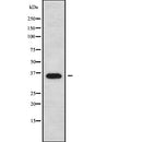 AF5440 at 1/100 staining Human uterus tissue by IHC-P. The sample was formaldehyde fixed and a heat mediated antigen retrieval step in citrate buffer was performed. The sample was then blocked and incubated with the antibody for 1.5 hours at 22¡ãC. An HRP conjugated goat anti-rabbit antibody was used as the secondary