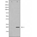 Western blot analysis of Phospho-MRLC1 (Ser19)  expression in K562 cell extract.The lane on the left is treated with the antigen-specific peptide.