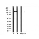 AF5444 at 1/100 staining Mouse lung tissue by IHC-P. The sample was formaldehyde fixed and a heat mediated antigen retrieval step in citrate buffer was performed. The sample was then blocked and incubated with the antibody for 1.5 hours at 22¡ãC. An HRP conjugated goat anti-rabbit antibody was used as the secondary