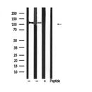 AF5445 at 1/200 staining human kidney tissue sections by IHC-P. The tissue was formaldehyde fixed and a heat mediated antigen retrieval step in citrate buffer was performed. The tissue was then blocked and incubated with the antibody for 1.5 hours at 22¡ãC. An HRP conjugated goat anti-rabbit antibody was used as the secondary