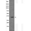 Western blot analysis of extracts from Hela, using OR51E2 Antibody. The lane on the left was treated with blocking peptide.