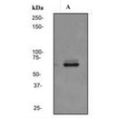 Western blot analysis of extracts from Mouse  heart, using TGFBR2 Antibody. The lane on the left was treated with blocking peptide.