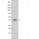 AF5450 staining Hela by IF/ICC. The sample were fixed with PFA and permeabilized in 0.1% Triton X-100,then blocked in 10% serum for 45 minutes at 25¡ãC. The primary antibody was diluted at 1/200 and incubated with the sample for 1 hour at 37¡ãC. An  Alexa Fluor 594 conjugated goat anti-rabbit IgG (H+L) Ab, diluted at 1/600, was used as the secondary antibod