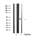 AF5451 at 1/100 staining Mouse lung tissue by IHC-P. The sample was formaldehyde fixed and a heat mediated antigen retrieval step in citrate buffer was performed. The sample was then blocked and incubated with the antibody for 1.5 hours at 22¡ãC. An HRP conjugated goat anti-rabbit antibody was used as the secondary