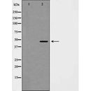 AF5454 at 1/100 staining Mouse testis tissue by IHC-P. The sample was formaldehyde fixed and a heat mediated antigen retrieval step in citrate buffer was performed. The sample was then blocked and incubated with the antibody for 1.5 hours at 22¡ãC. An HRP conjugated goat anti-rabbit antibody was used as the secondary