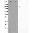 AF5456 at 1/100 staining Human Melanoma tissue by IHC-P. The sample was formaldehyde fixed and a heat mediated antigen retrieval step in citrate buffer was performed. The sample was then blocked and incubated with the antibody for 1.5 hours at 22¡ãC. An HRP conjugated goat anti-rabbit antibody was used as the secondary