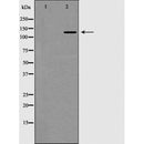 AF5457 at 1/100 staining Human uterus tissue by IHC-P. The sample was formaldehyde fixed and a heat mediated antigen retrieval step in citrate buffer was performed. The sample was then blocked and incubated with the antibody for 1.5 hours at 22¡ãC. An HRP conjugated goat anti-rabbit antibody was used as the secondary