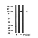 AF5459 at 1/100 staining Human liver cancer tissue by IHC-P. The sample was formaldehyde fixed and a heat mediated antigen retrieval step in citrate buffer was performed. The sample was then blocked and incubated with the antibody for 1.5 hours at 22¡ãC. An HRP conjugated goat anti-rabbit antibody was used as the secondary