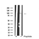 Western blot analysis of extracts from HepG2, using GluR6 Antibody. The lane on the left was treated with blocking peptide.
