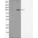AF5461 at 1/100 staining Human urothelial cancer tissue by IHC-P. The sample was formaldehyde fixed and a heat mediated antigen retrieval step in citrate buffer was performed. The sample was then blocked and incubated with the antibody for 1.5 hours at 22¡ãC. An HRP conjugated goat anti-rabbit antibody was used as the secondary