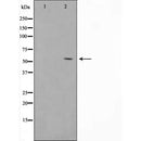 Western blot analysis of extracts from B16F10, using GLUT1 Antibody. The lane on the left was treated with blocking peptide.
