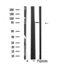 Western blot analysis of extracts from COS-7, using p73 Antibody. The lane on the left was treated with blocking peptide.