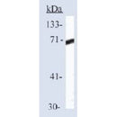 AF5466 at 1/100 staining Rat heart tissue by IHC-P. The sample was formaldehyde fixed and a heat mediated antigen retrieval step in citrate buffer was performed. The sample was then blocked and incubated with the antibody for 1.5 hours at 22¡ãC. An HRP conjugated goat anti-rabbit antibody was used as the secondary