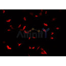 Western blot analysis of extracts from MCF7, using COX IV Antibody. The lane on the left was treated with blocking peptide.