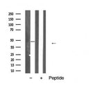 Western blot analysis of extracts from Mouse  brain, using TNF Receptor II Antibody. The lane on the left was treated with blocking peptide.