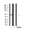 Western blot analysis of extracts from various samples, using NSE Antibody.
 Lane 1: Mouse muscle treated with blocking peptide;
 Lane 2: Mouse muscle;
 Lane 3: Rat liver;
 Lane 4: Hela.