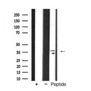 Western blot analysis of extracts from MCF7, using TBP Antibody. The lane on the left was treated with blocking peptide.