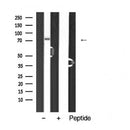 AF5477 staining HUVEC by IF/ICC. The sample were fixed with PFA and permeabilized in 0.1% Triton X-100,then blocked in 10% serum for 45 minutes at 25¡ãC. The primary antibody was diluted at 1/200 and incubated with the sample for 1 hour at 37¡ãC. An  Alexa Fluor 594 conjugated goat anti-rabbit IgG (H+L) Ab, diluted at 1/600, was used as the secondary antibod