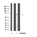 AF5479 at 1/100 staining Human colon cancer tissue by IHC-P. The sample was formaldehyde fixed and a heat mediated antigen retrieval step in citrate buffer was performed. The sample was then blocked and incubated with the antibody for 1.5 hours at 22¡ãC. An HRP conjugated goat anti-rabbit antibody was used as the secondary
