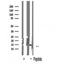Western blot analysis of extracts from Hela, using p16 INK Antibody. The lane on the left was treated with blocking peptide.