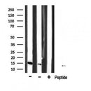 Western blot analysis of extracts from HepG2, using p15 INK Antibody. The lane on the left was treated with blocking peptide.