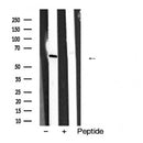 Western blot analysis of extracts from Hela, using p63 Antibody. The lane on the left was treated with blocking peptide.