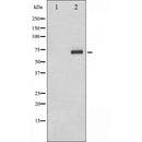 Western blot analysis of extracts from HUVEC, using Tyrosinase Antibody. The lane on the left was treated with blocking peptide.
